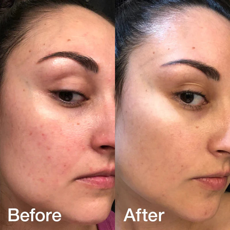 Collagen Night Wrapping Mask Bundle